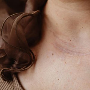 scar restoration solutions paramedical tattooing