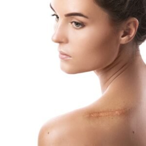scar restoration solutions