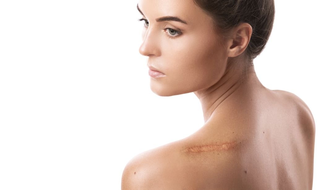 scar restoration solutions