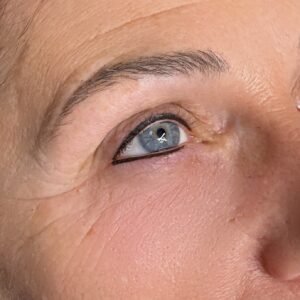 Lash Enhancement
