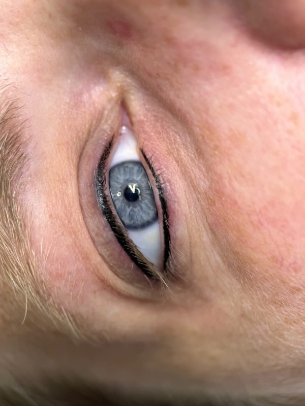 Lash Enhancement
