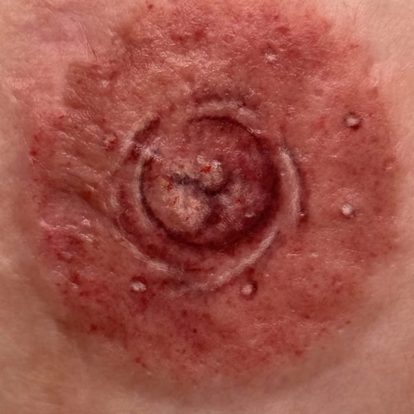 3D Areola Tattoo Up Close