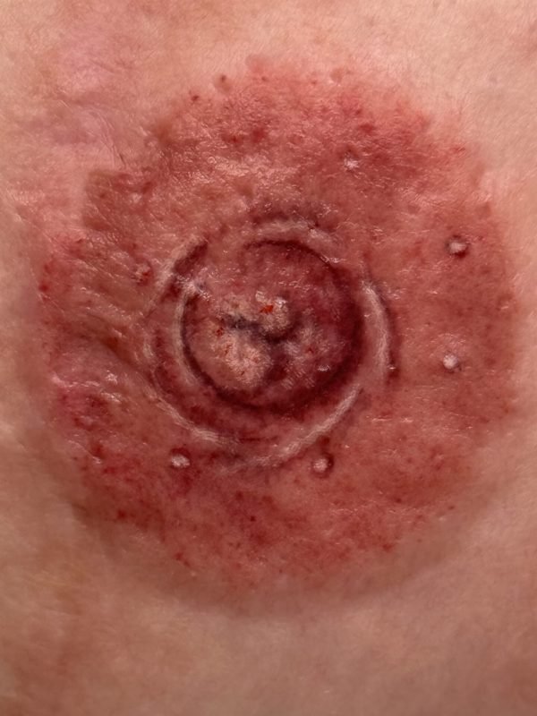 3D Areola Tattoo Up Close