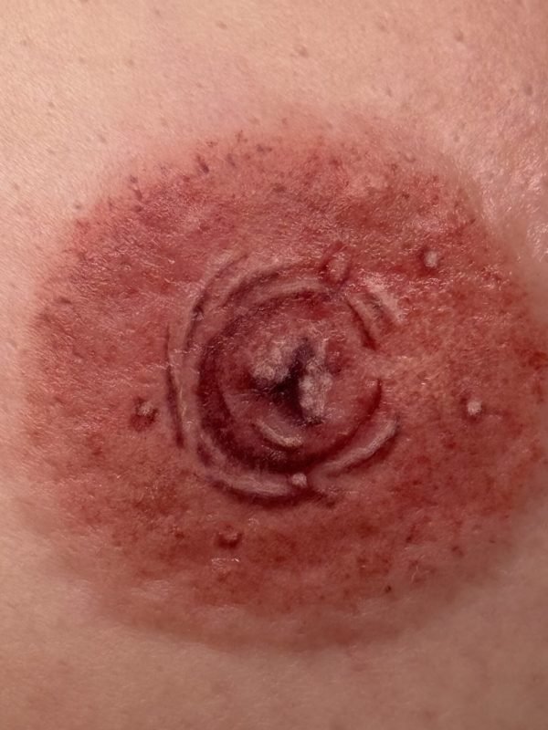 3D Areola Tattoo Up Close